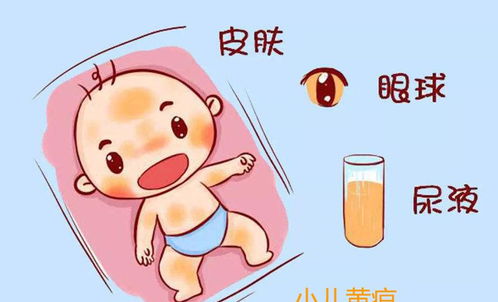 黄疸的健康指导内容