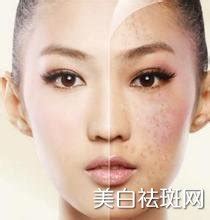 cc光祛斑有什么副作用