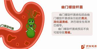 胃癌的症状有哪些?我会不会是胃癌