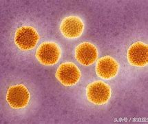 揭秘甲肝不容忽视的早期症状