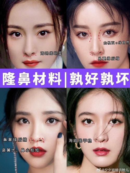 假体隆鼻对身体的危害