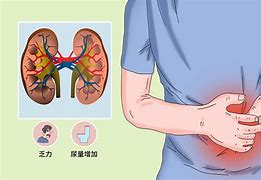 肾病综合征不复发能活多久