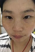 脸上有斑怎么去除掉